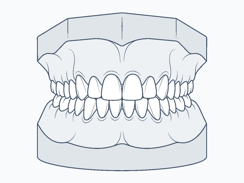 12. Mẫu cắn thẳng